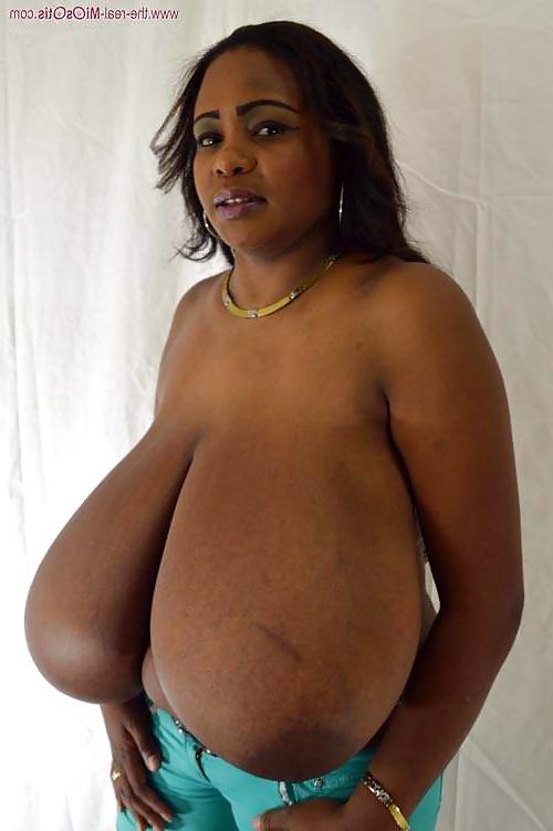 20P Extreme Macromastia Black Boobs 1  