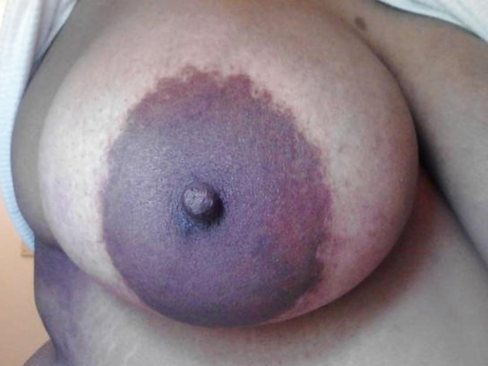 25P Big black areolas ----massive collection---- part 22
