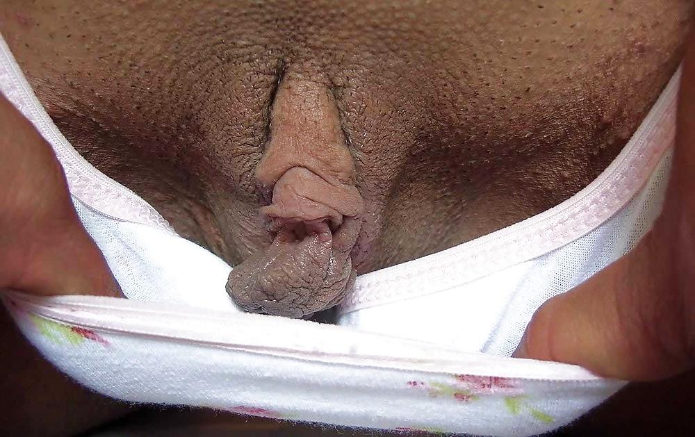 9P Big labia