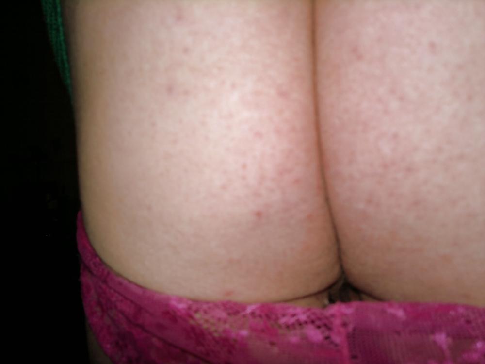 7P Pink Lace
