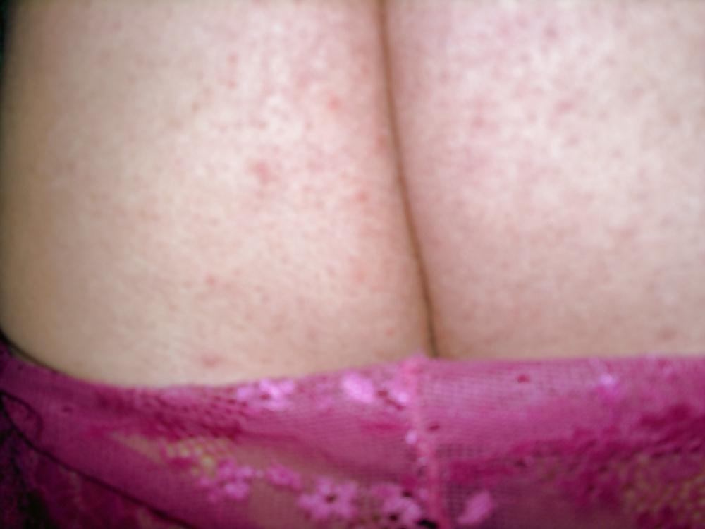 7P Pink Lace