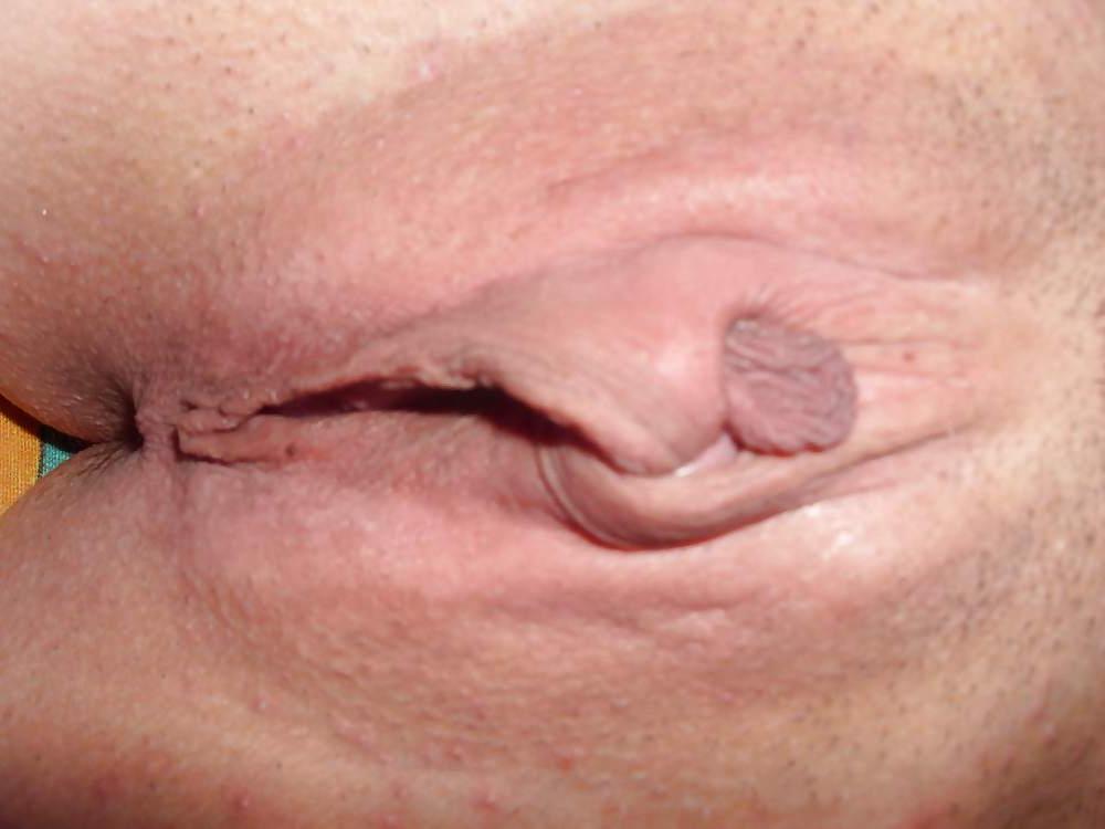 21P Stretching Labia ana tied