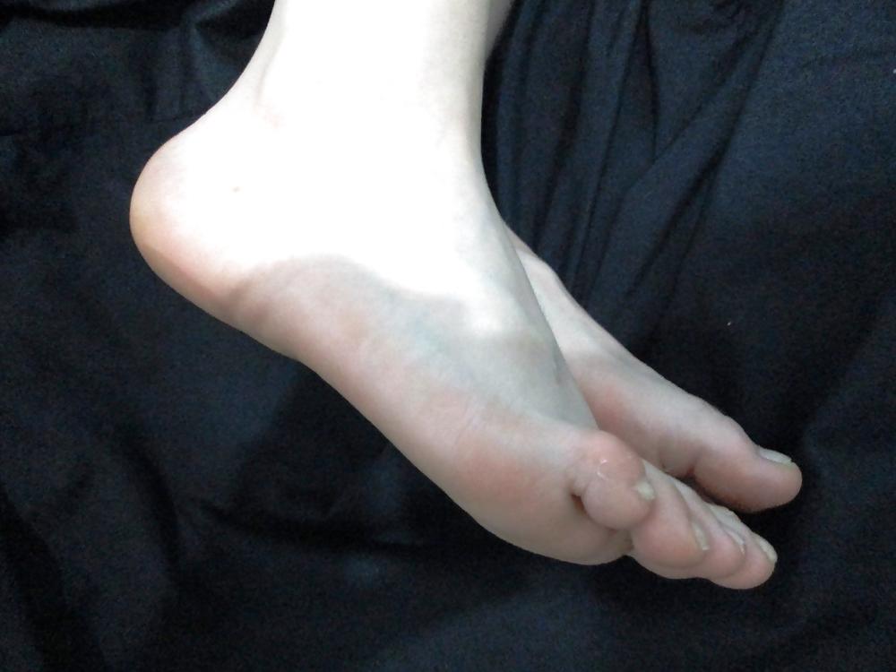 25P Redhead Girl Feet, Soles and Toes
