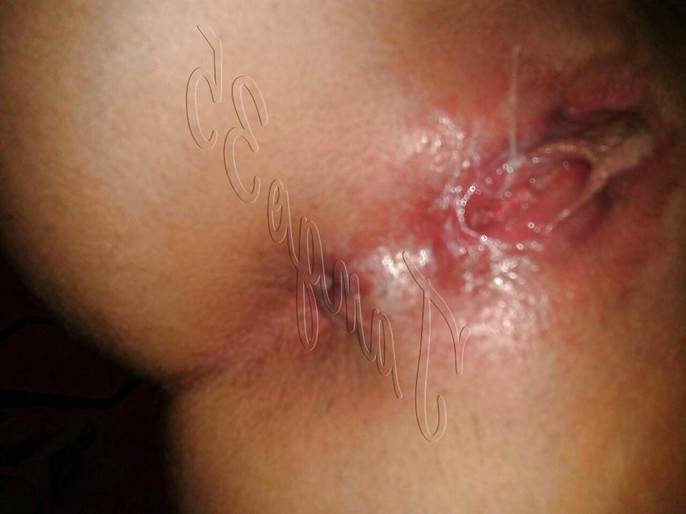 14P Turkish Slut Elmas