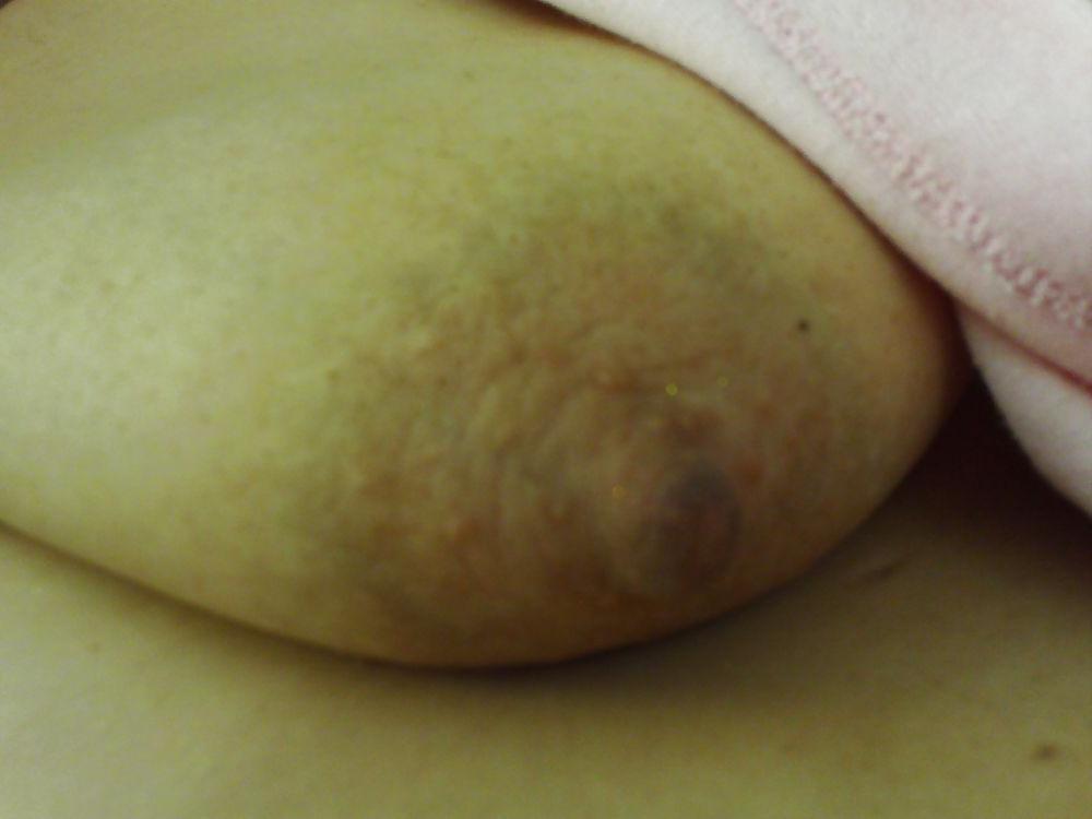 24P Nipple Closeups