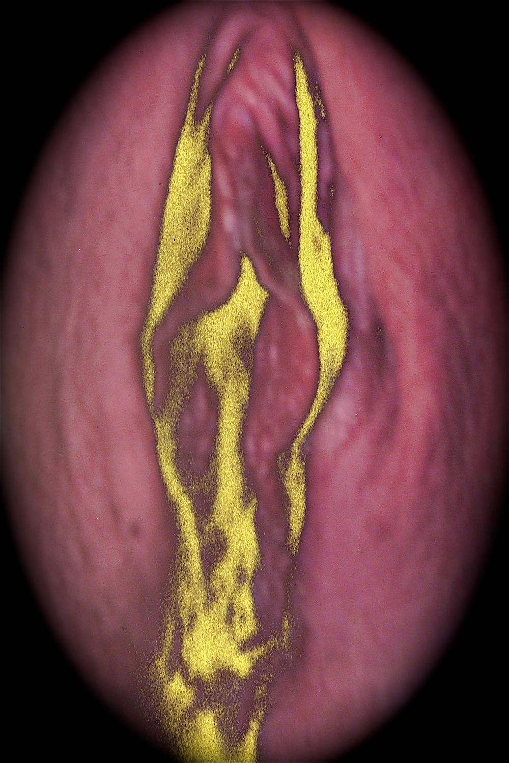 22P Labia love