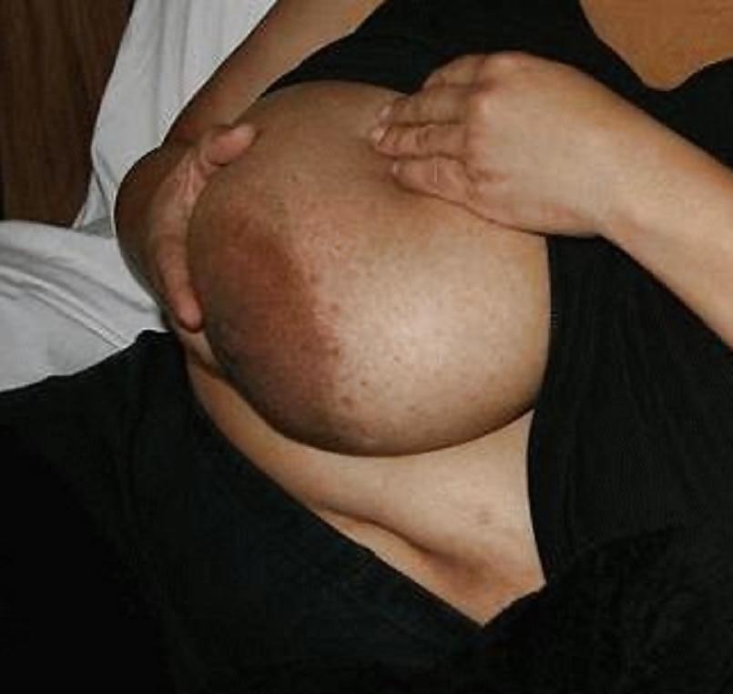 25P Big black areolas part 33