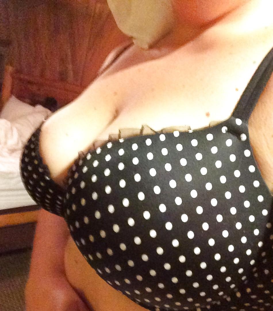 7P Cleavage 