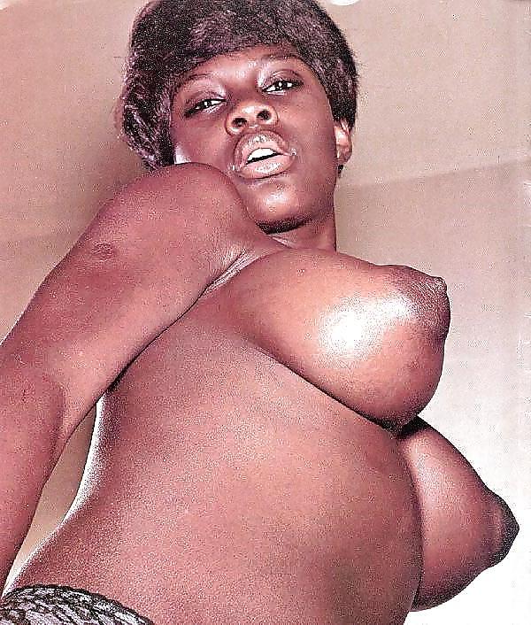 19P Strange breast nipple and areola