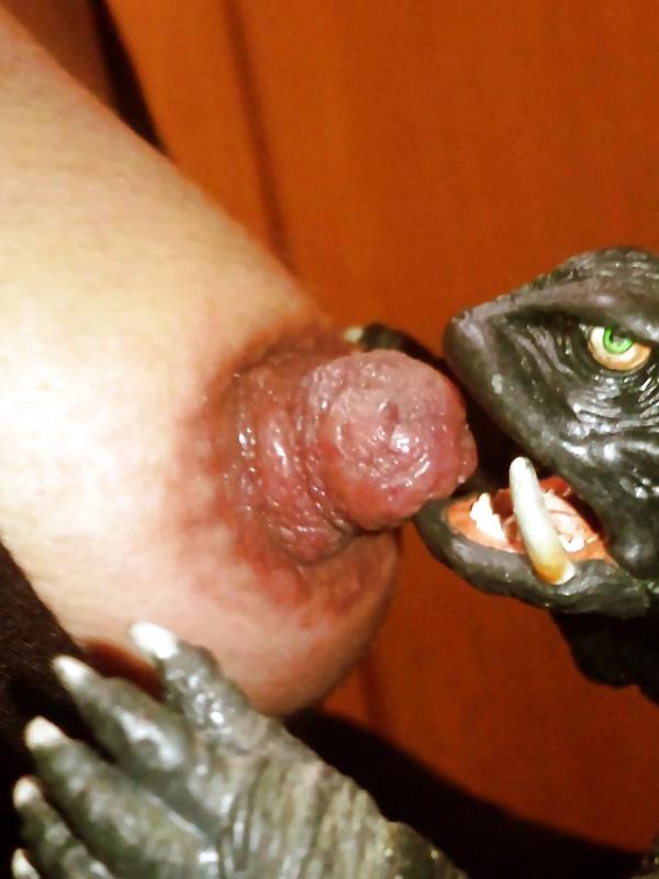 25P Nipples were enlarged by suction