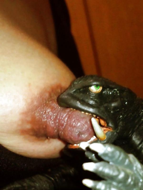 25P Nipples were enlarged by suction