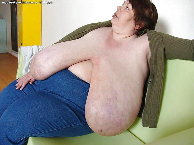 25P Ugly tities 