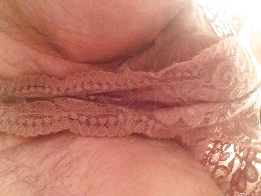 5P Lace