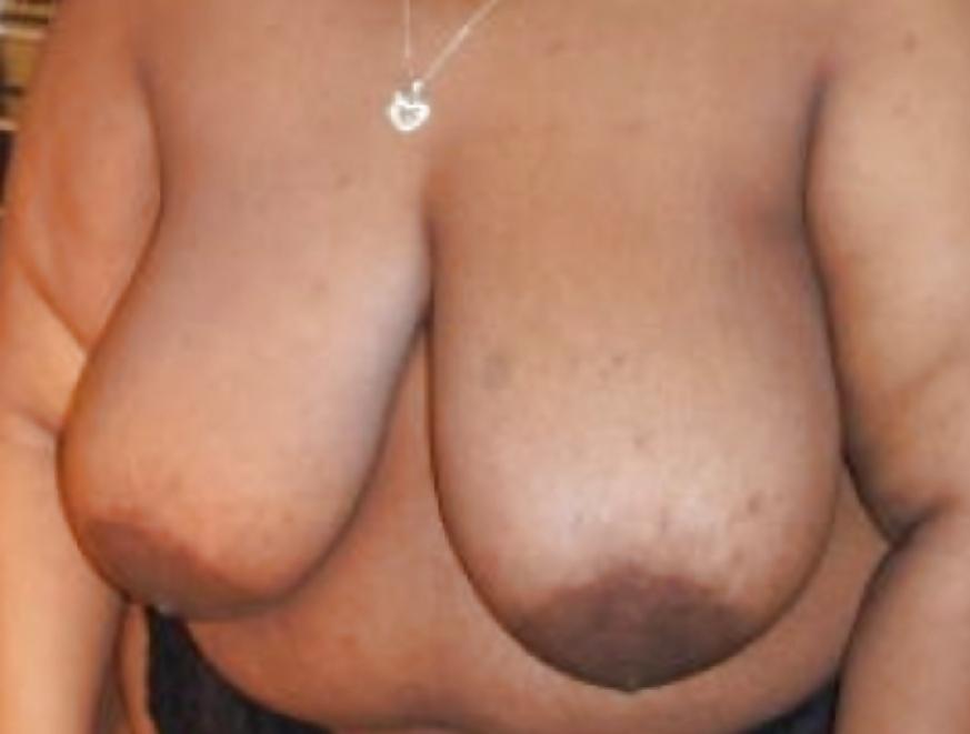 25P Big black areolas part 34