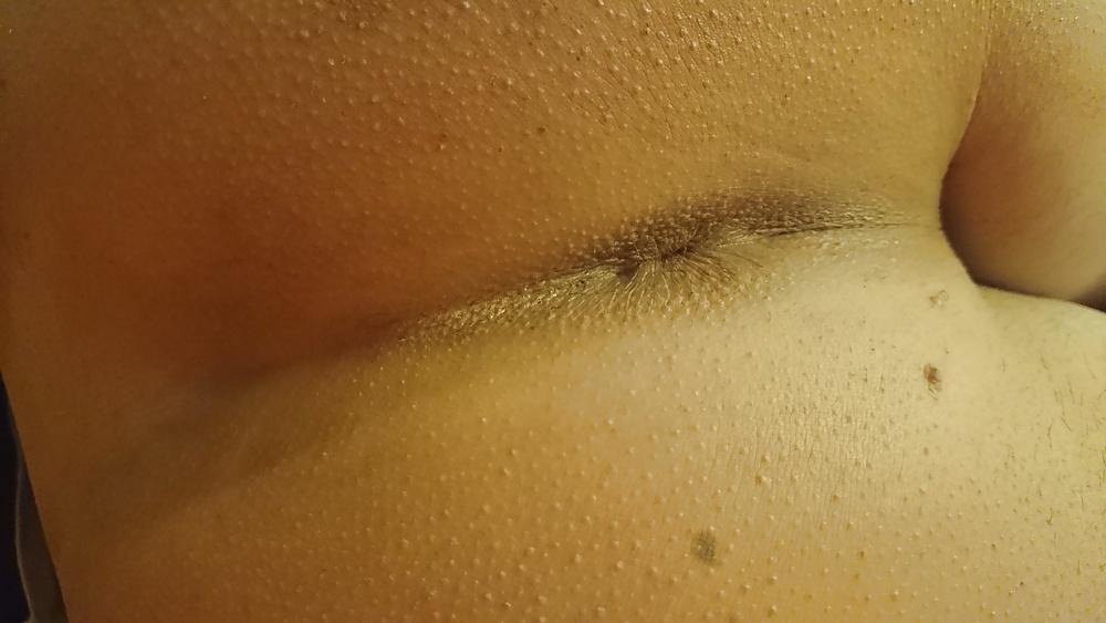 20P Twink ass