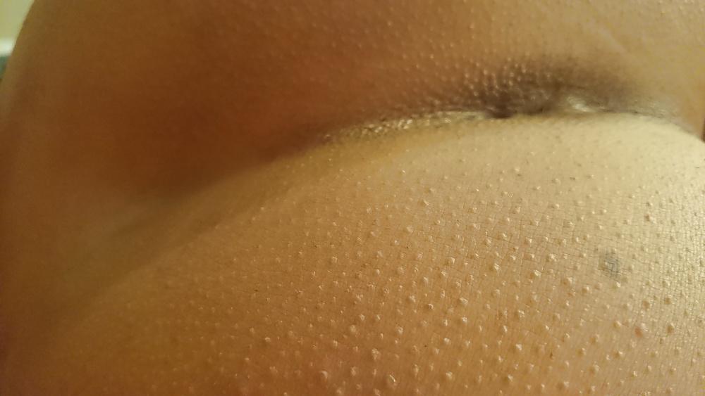 20P Twink ass
