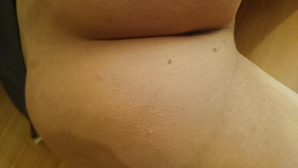 20P Twink ass