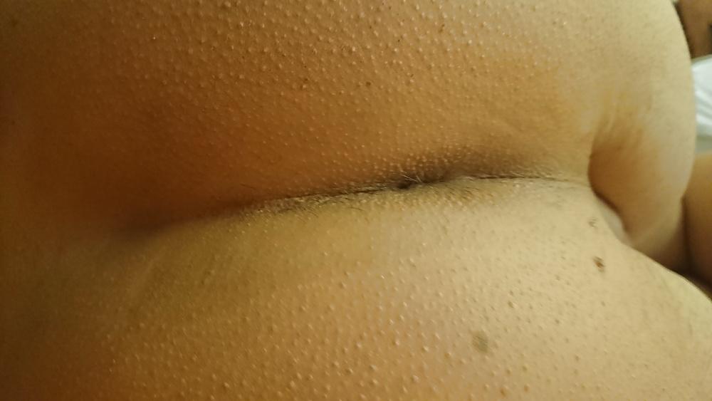 20P Twink ass