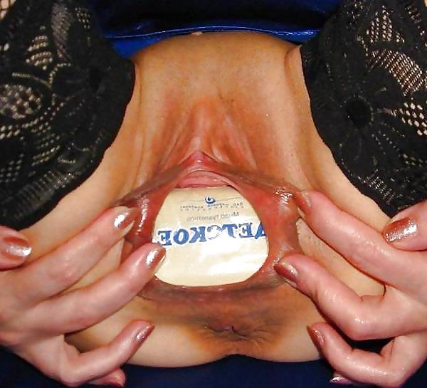 20P Odd Insertions: Ripples Belive It Or Not Candidates #35