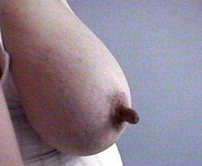 25P Gorgeous nipples 1