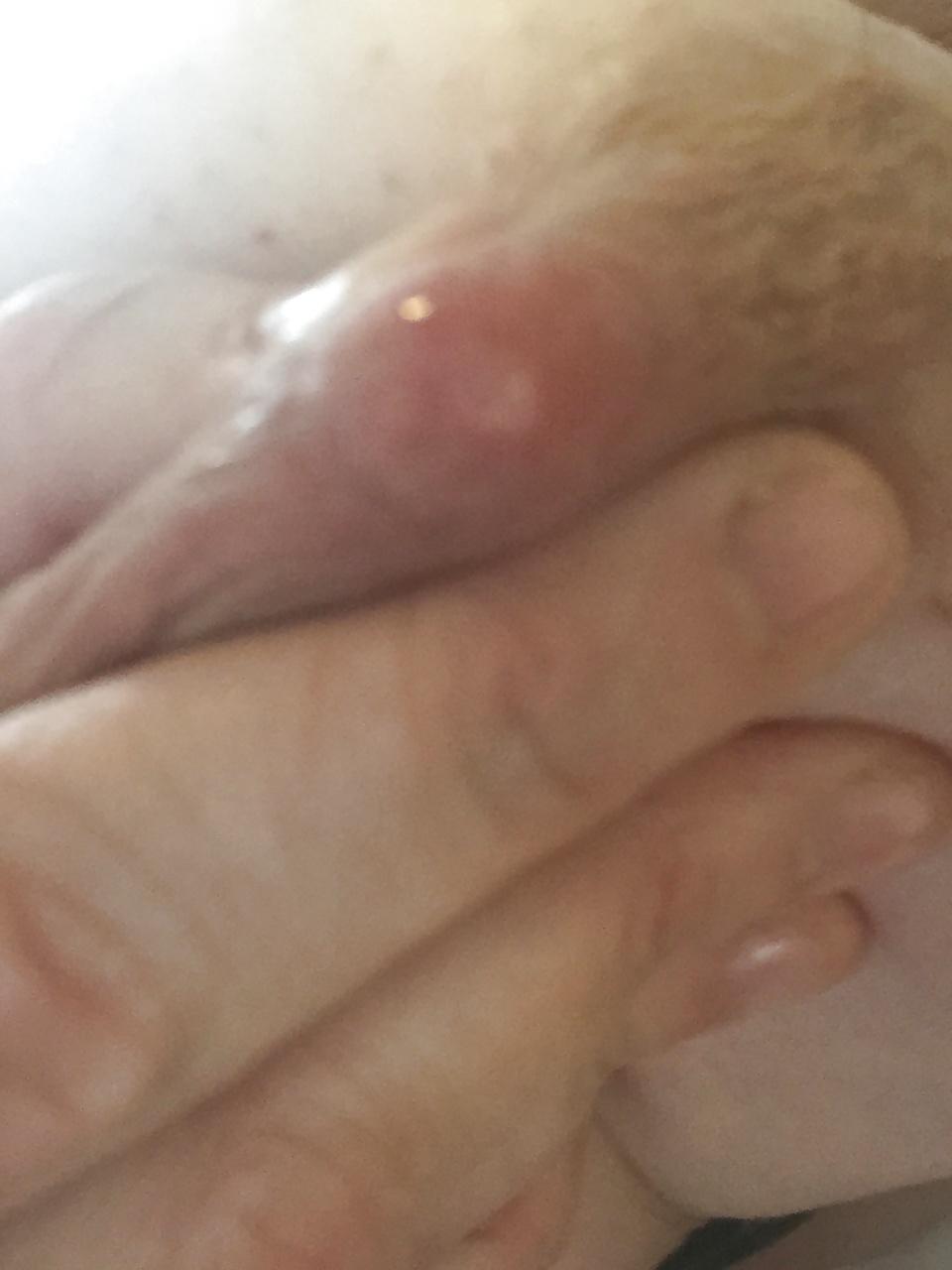14P Lactating 40h tits