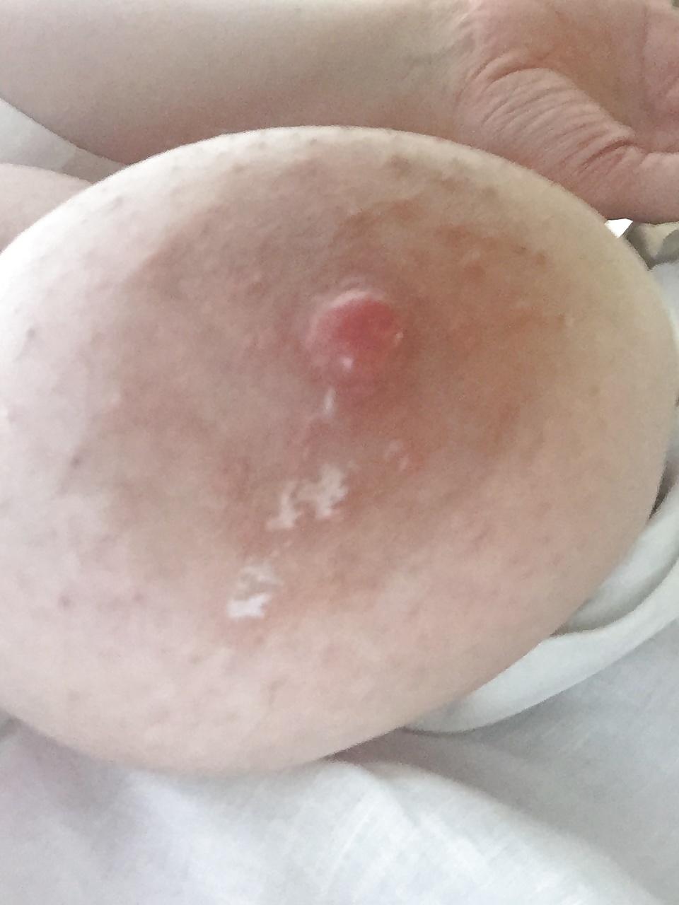 14P Lactating 40h tits