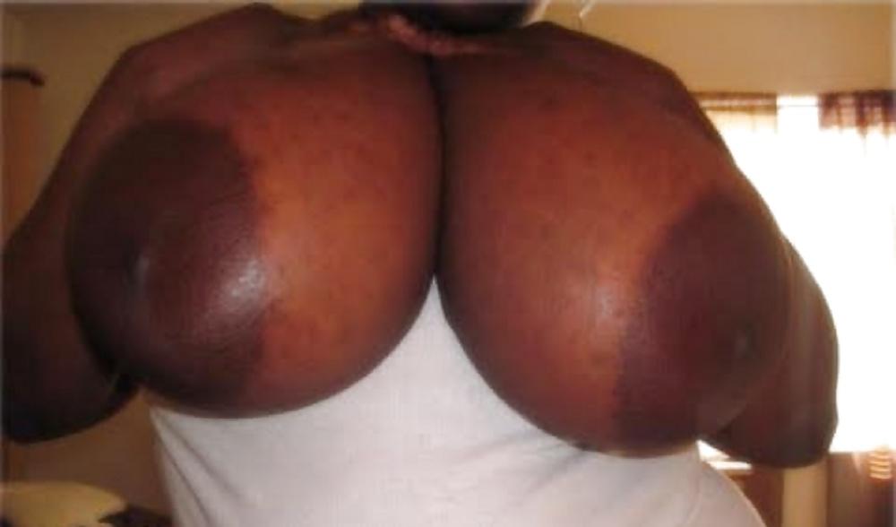 25P Big black areolas part 36