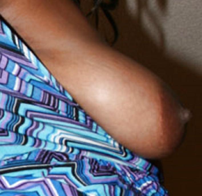25P Big black areolas part 36