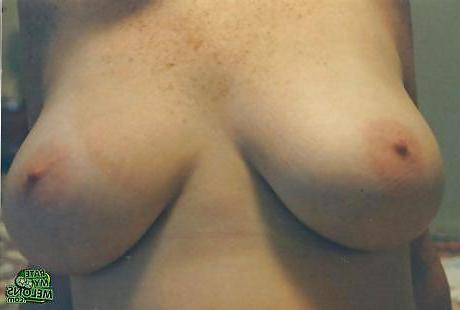25P Knockers&Racks Gallery 1