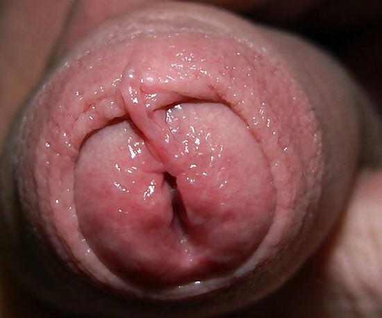 7P Uncut FORESKIN Cum Pics