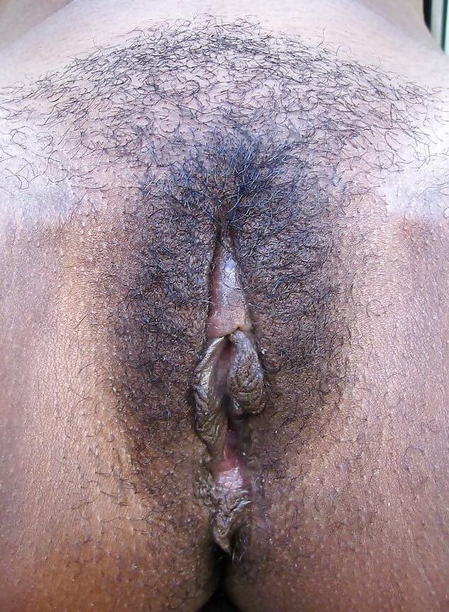 25P Hairy Black Women