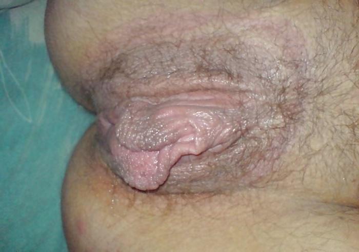 25P Large labia (web found)