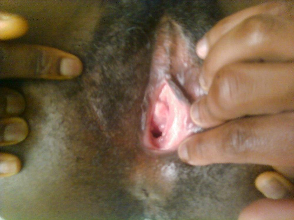 12P Black Teens
