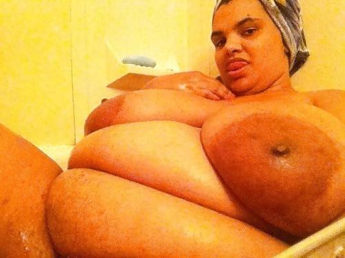 25P Massive dark areolas