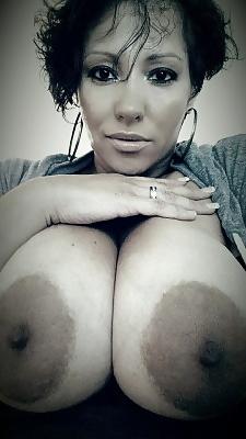 25P Massive dark areolas