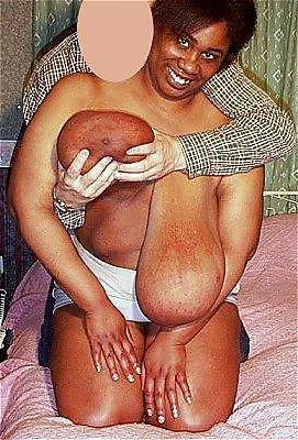 25P Big Black Boobs