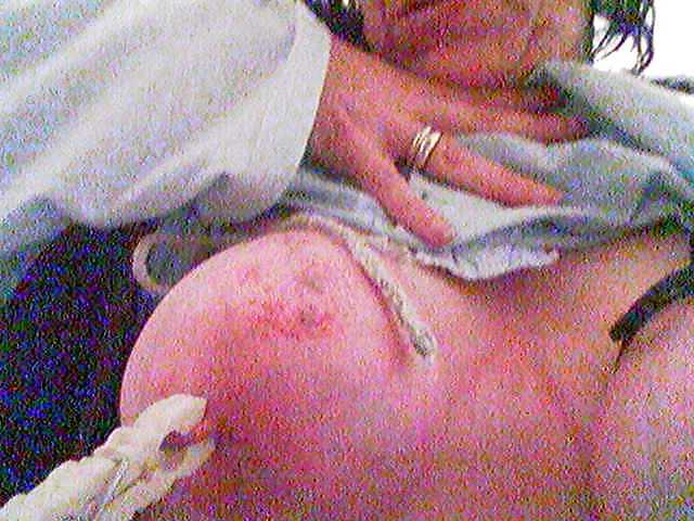 8P Tit torture di una bbw 40enne (Slave C)