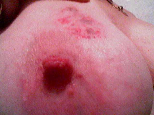 8P Tit torture di una bbw 40enne (Slave C)