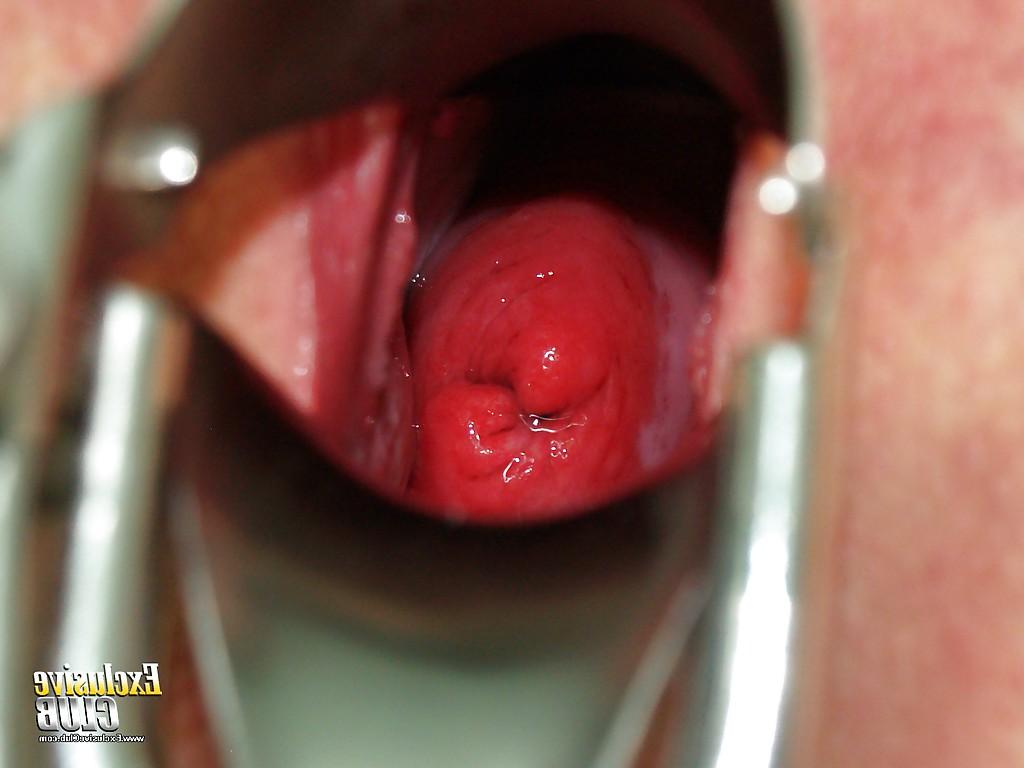 16P Fetish close up pussy showing brunette Silvia is at the gyno doctor