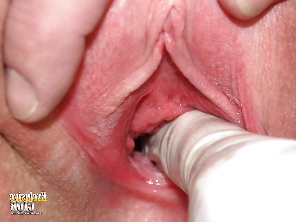 16P Fetish close up pussy showing brunette Silvia is at the gyno doctor