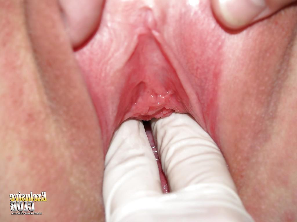 16P Fetish close up pussy showing brunette Silvia is at the gyno doctor