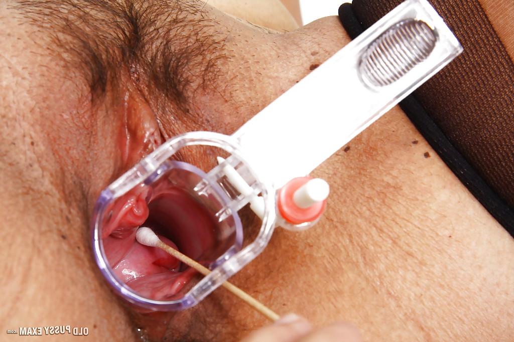 16P Older lady Rosita Black visits Gyno doctor for hairy pussy examination