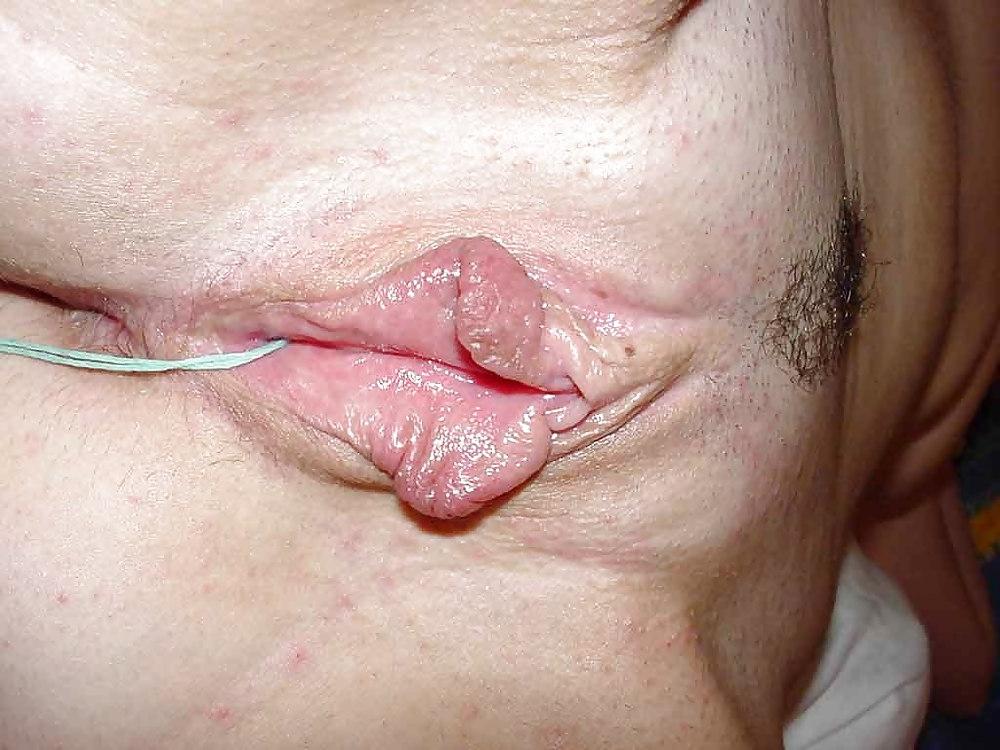 25P Big Clits and Lips