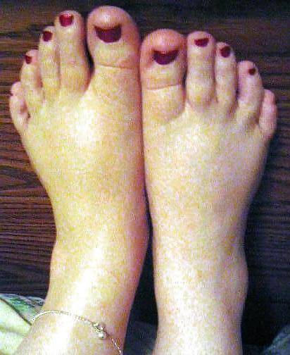 6P BBW (For feet lovers)