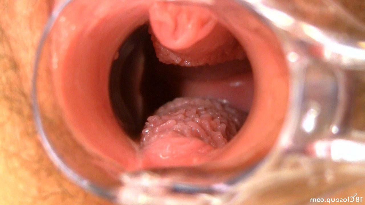 16P Hairy Teen Orgasm Contractions With Speculum