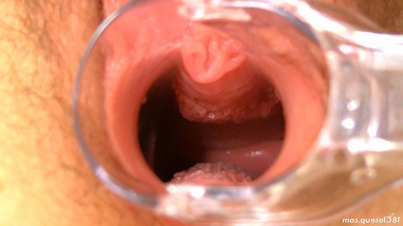 16P Hairy Teen Orgasm Contractions With Speculum