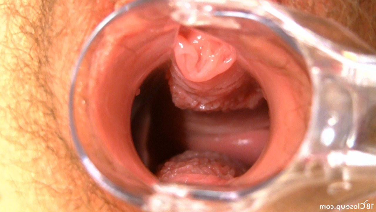 16P Hairy Teen Orgasm Contractions With Speculum