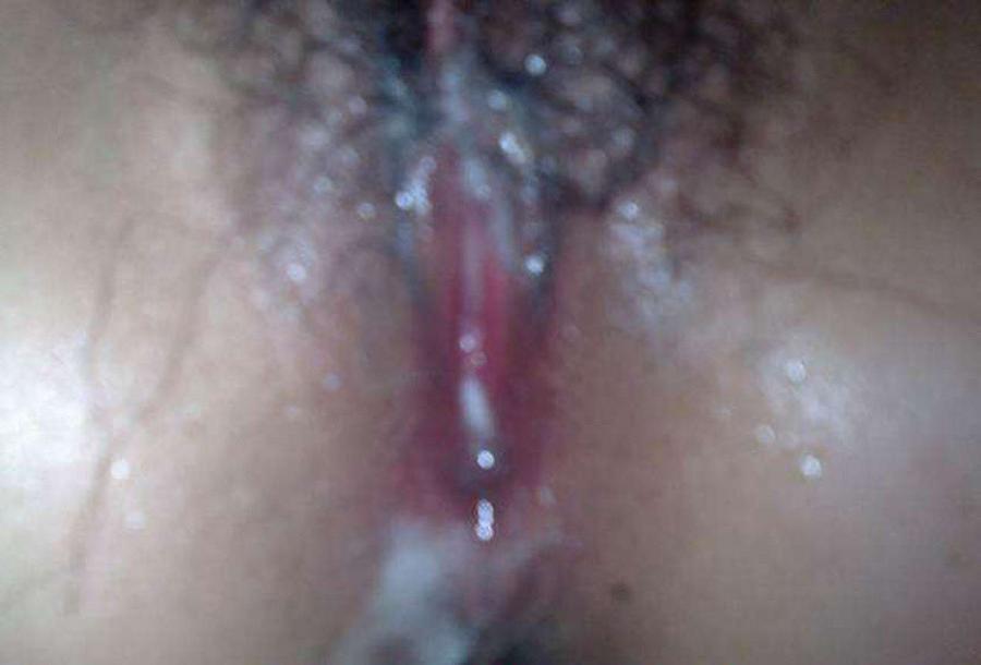 10P Pictures of a Korean babe's pussy that got creampied