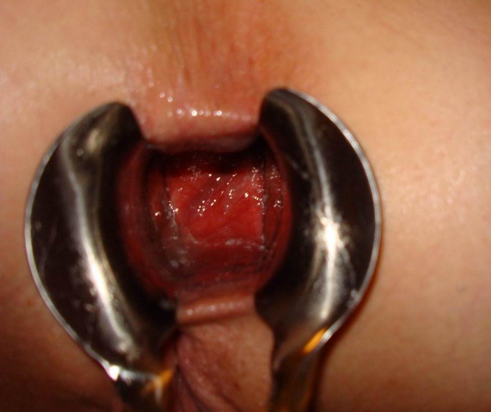 18P extremely gaping ass and pussy holes