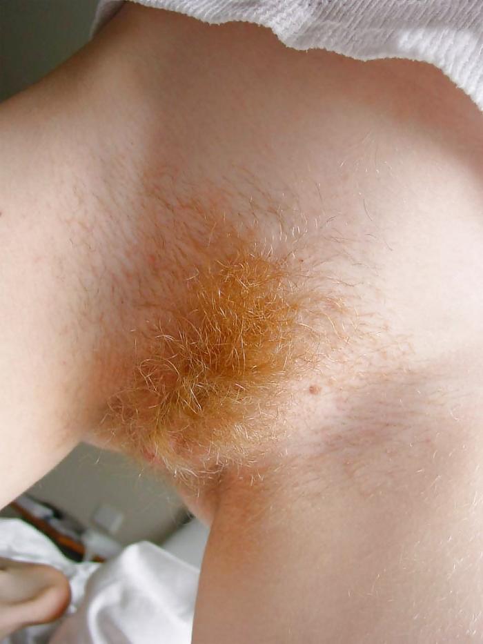 25P More Red Pussy